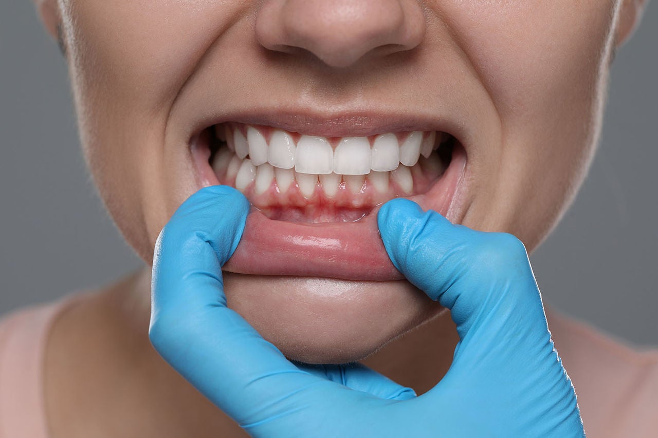 woman showing healthy gums on gray