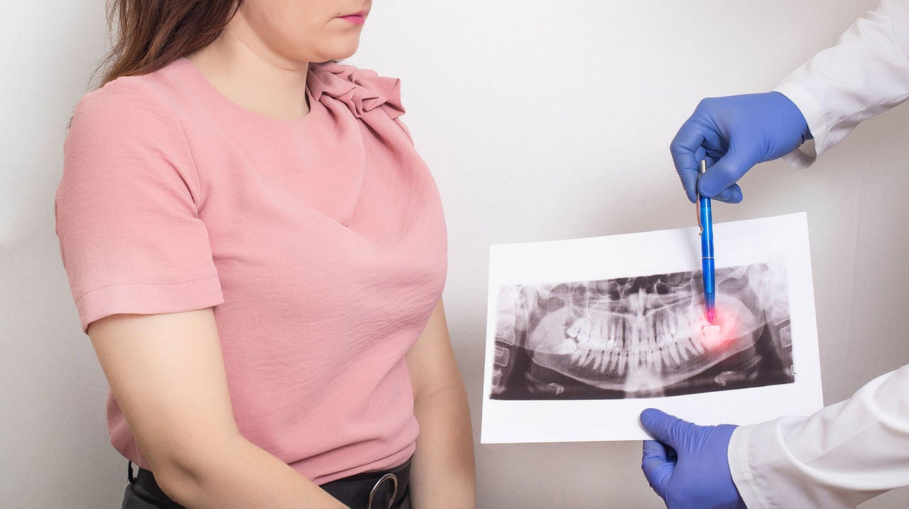 doctor holds panoramic xray picture patients