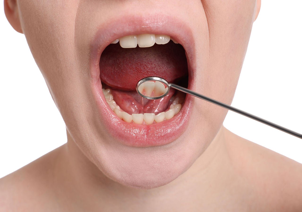 examining young womans teeth gums mirror